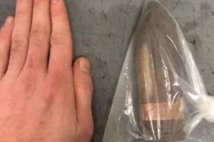 Hospital chama esquadrão antibombas para homem com projétil “introduzido” no ânus