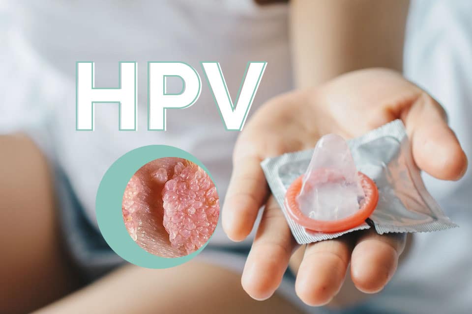 ALÔ DOUTOR: O QUE VOCÊ PRECISA SABER SOBRE O HPV