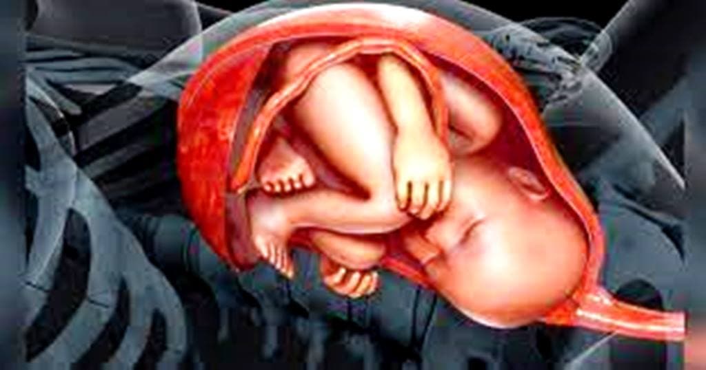 ALÔ DOUTOR: IMPORTANTE SABER sobre Circulares do Cordão Umbilical
